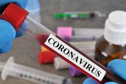 Au Cameroun, des tests massifs pour endiguer le coronavirus