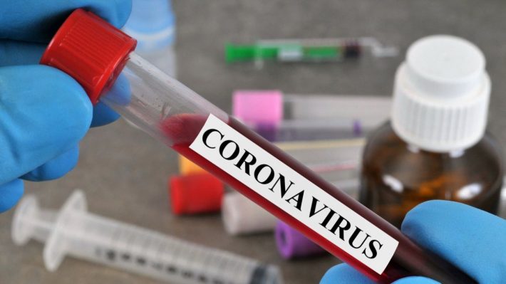 Au Cameroun, des tests massifs pour endiguer le coronavirus