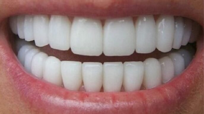 dents blanches