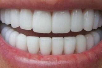 Dents blanches