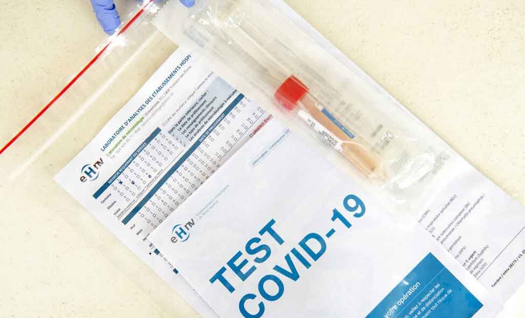 05 élèves testés positifs au coronavirus au Togo